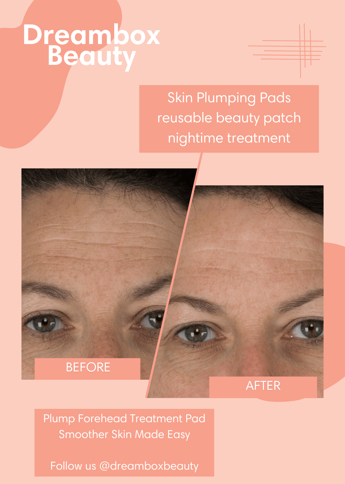 Forehead Wrinkle Patch | Reusable Skin Plumping Forehead Mask