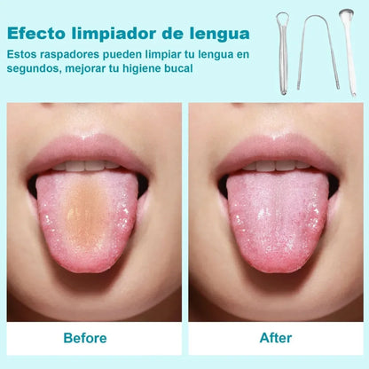 3-Pack Tongue Cleaner Kit